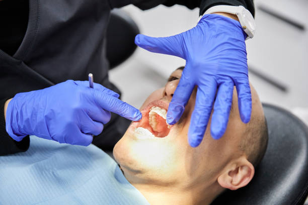 Best Emergency Treatment for Dental Infections or Abscesses in Bishopville, SC